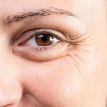 Close-up of an eye with wrinkles around it image on padma home page